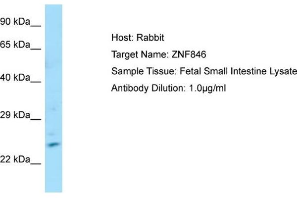 ZNF846 抗体  (N-Term)
