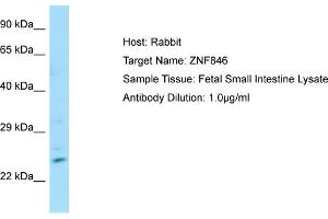 Host: Rabbit Target Name: ZNF846 Sample Type: Fetal Small Intestine lysates Antibody Dilution: 1. (ZNF846 抗体  (N-Term))