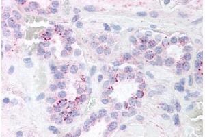 Human Kidney (formalin-fixed, paraffin-embedded) stained with RELA antibody ABIN214452 at 5 ug/ml followed by biotinylated goat anti-rabbit IgG secondary antibody ABIN481713, alkaline phosphatase-streptavidin and chromogen. (NF-kB p65 抗体)
