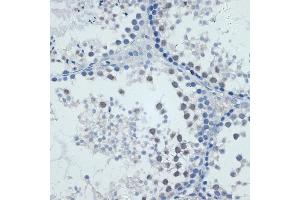 Immunohistochemistry (IHC) image for anti-Matrix Metallopeptidase 9 (Gelatinase B, 92kDa Gelatinase, 92kDa Type IV Collagenase) (MMP9) (AA 538-707) antibody (ABIN6143920)