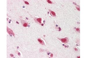 Anti-ZNF461 antibody IHC staining of human brain, cortex. (ZNF461 抗体  (AA 126-425))