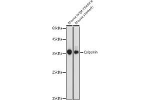 Western blot analysis of extracts of various cell lines, using Calponin antibody (ABIN7266040) at 1:1000 dilution. (CNN1 抗体  (AA 130-180))