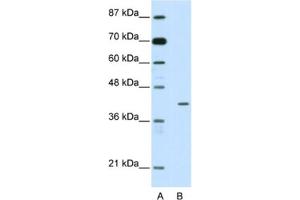 Western Blotting (WB) image for anti-Homeobox Containing 1 (HMBOX1) antibody (ABIN2461931)