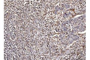 IHC analysis of ACADM/MCAD using anti-ACADM/MCAD antibody (ABIN7601543). (Medium-Chain Specific Acyl-CoA Dehydrogenase, Mitochondrial (MCAD) (AA 38-401) 抗体)