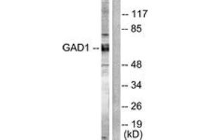 Western blot analysis of extracts from mouse brain cells, using GAD1/2 Antibody. (GAD65+GAD67 (AA 545-594) 抗体)
