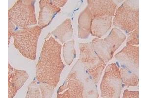 IHC-P analysis of Rat Skeletal muscle Tissue, with DAB staining. (SIGIRR 抗体  (AA 1-118))