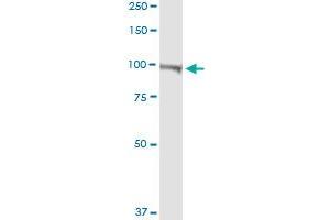 Western Blotting (WB) image for anti-ATPase, Ca++ Transporting, Plasma Membrane 4 (ATP2B4) (AA 1-1170) antibody (ABIN947595)