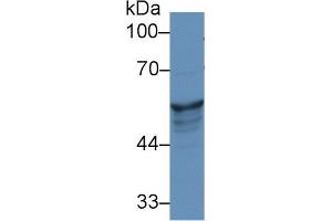 Western Blot; Sample: Human A431 cell lysate; Primary Ab: 1µg/ml Rabbit Anti-Rat KRT8 Antibody Second Ab: 0.