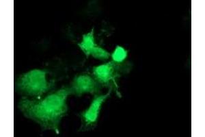 Image no. 7 for anti-Pyrroline-5-Carboxylate Reductase 3 (PYCRL) antibody (ABIN1500522)