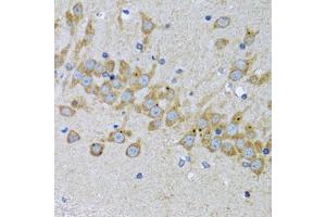 Immunohistochemistry of paraffin-embedded mouse brain using EIF2AK4 antibody. (GCN2 抗体)