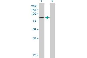 Western Blotting (WB) image for anti-Sodium Channel, Nonvoltage-Gated 1, delta (SCNN1D) (AA 1-638) antibody (ABIN520027)