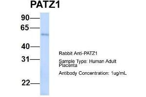 Host:  Rabbit  Target Name:  PATZ1  Sample Type:  Human Adult Placenta  Antibody Dilution:  1. (PATZ1 抗体  (N-Term))