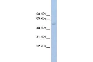 WB Suggested Anti-ANKRD13D Antibody Titration: 0. (ANKRD13D 抗体  (Middle Region))