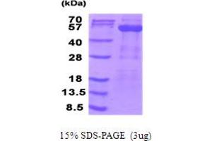 SDS-PAGE (SDS) image for Pyruvate Dehydrogenase Complex, Component X (PDHX) (AA 54-501) protein (His tag) (ABIN6387533) (PDHX Protein (AA 54-501) (His tag))