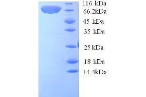 SDS-PAGE (SDS) image for Calpastatin (ICAL) (AA 1-667), (partial) protein (His tag) (ABIN5713314)