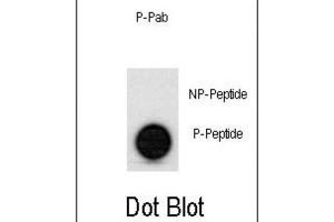 Dot Blot (DB) image for anti-Tumor Protein P53 (TP53) (pSer315) antibody (ABIN2970968)