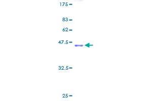 RPL11 Protein (AA 1-177) (GST tag)