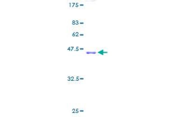 RPL11 Protein (AA 1-177) (GST tag)
