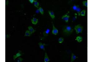 Immunofluorescence staining of SH-SY5Y cells with ABIN7175604 at 1:50, counter-stained with DAPI. (CACNA1B 抗体  (AA 2132-2339))