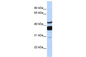 Western Blotting (WB) image for anti-Ceramide Synthase 2 (CERS2) antibody (ABIN2457964) (Ceramide Synthase 2 抗体)