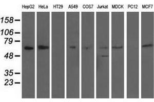 Western blot analysis of extracts (35 µg) from 9 different cell lines by using anti-AFP monoclonal antibody. (alpha Fetoprotein 抗体)