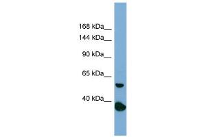 Host:  Rabbit  Target Name:  RAD50  Sample Type:  PANC1 Whole Cell lysates  Antibody Dilution:  1. (RAD50 抗体  (N-Term))