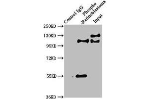 Immunoprecipitating Phospho-RB1 in Hela whole cell lysate Lane 1: Rabbit control IgG(1 μg)instead of ABIN7127740 in Hela whole cell lysate. (Recombinant Retinoblastoma 1 抗体  (pSer780))