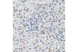 Immunohistochemistry of paraffin-embedded mouse kidney using ILK Antibody.