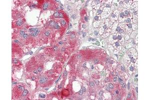Immunohistochemistry (IHC) image for anti-ATPase, H+ Transporting, Lysosomal Accessory Protein 2 (ATP6AP2) (AA 146-320) antibody (ABIN467627)