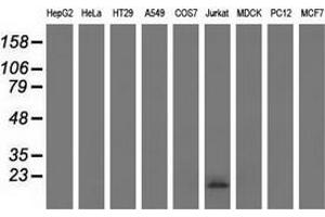 Western blot analysis of extracts (35 µg) from 9 different cell lines by using anti-EFNA2 monoclonal antibody.