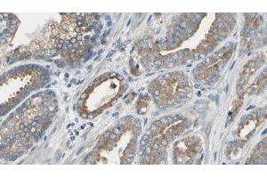 ABIN6277635 at 1/100 staining Human prostate tissue by IHC-P. (PNMT 抗体  (N-Term))
