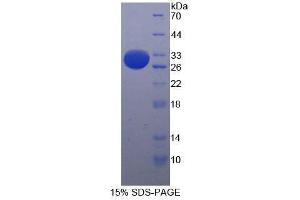 SDS-PAGE analysis of Mouse Integrin alpha E Protein. (CD103 蛋白)