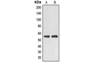 Western blot analysis of EMR4 expression in HeLa (A), HuvEc (B) whole cell lysates. (EMR4 抗体  (Center))