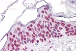Human Skin: Formalin-Fixed, Paraffin-Embedded (FFPE) (SIRT1 抗体  (AA 456-555))