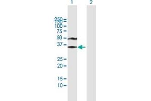 Western Blot analysis of ACRV1 expression in transfected 293T cell line by ACRV1 MaxPab polyclonal antibody.