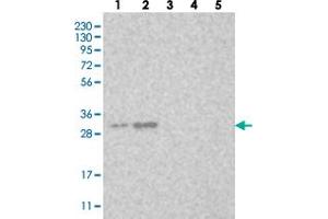 Western blot analysis of Lane 1: RT-4, Lane 2: U-251 MG, Lane 3: Human Plasma, Lane 4: Liver, Lane 5: Tonsil with LOC153364 polyclonal antibody  at 1:250-1:500 dilution.