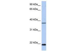 HDDC3 抗体  (C-Term)
