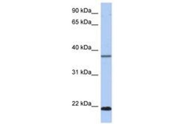 HDDC3 antibody  (C-Term)
