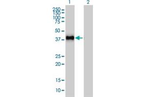 Western Blotting (WB) image for anti-GRB2-Related Adaptor Protein 2 (GRAP2) (AA 226-316) antibody (ABIN599077) (GRAP2 抗体  (AA 226-316))
