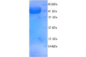 SDS-PAGE (SDS) image for Myosin Binding Protein C, Fast Type (MYBPC2) (AA 739-1141), (partial) protein (His tag) (ABIN5714324) (MYBPC2 Protein (AA 739-1141, partial) (His tag))