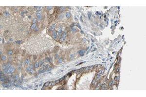 ABIN6272911 at 1/100 staining Human prostate tissue by IHC-P.