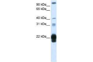 WB Suggested Anti-CSH1 Antibody Titration:  1. (CSH1 抗体  (Middle Region))