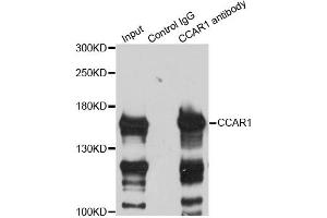 Immunoprecipitation analysis of 200ug extracts of HeLa cells using 3ug CCAR1 antibody (ABIN6291285). (CCAR1 抗体)