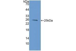 Western Blotting (WB) image for anti-Proteasome (Prosome, Macropain) Subunit, beta Type, 9 (Large Multifunctional Peptidase 2) (PSMB9) (AA 22-219) antibody (ABIN7442633)