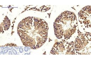 Immunohistochemistry of paraffin-embedded Mouse testis tissue using MICU1 Monoclonal Antibody at dilution of 1:200.