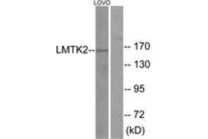Western blot analysis of extracts from LOVO cells, using LMTK2 Antibody. (LMTK2 抗体  (AA 651-700))