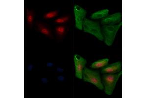 ABIN6255286 and ABIN6267647 staining  cells(H2O2 treatment) by IF/ICC. (IRF3 抗体  (pSer386))