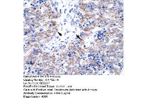Human Liver (HIV-1 Tat Interactive Protein 2, 30kDa (HTATIP2) (N-Term) 抗体)