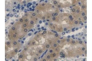 DAB staining on IHC-P; Samples: Rat Kidney Tissue (Biliverdin Reductase 抗体  (AA 10-279))