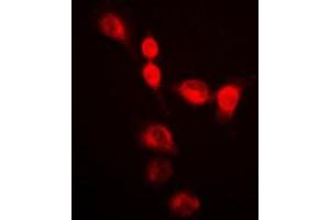 Immunofluorescent analysis of SMUG1 staining in HeLa cells. (SMUG1 抗体  (Center))